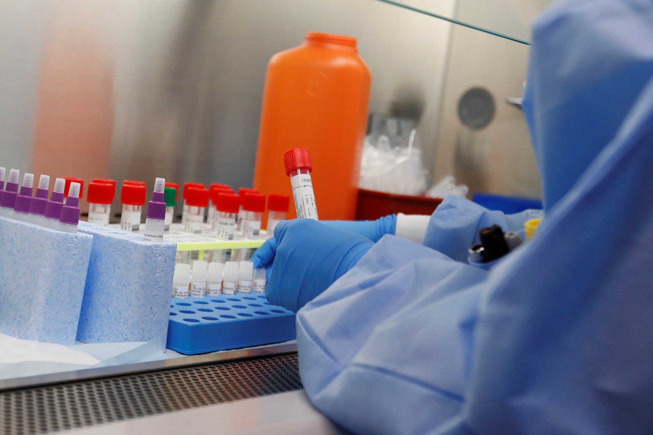 Νέο τεστ DNA ανιχνεύει ταυτόχρονα και με ακρίβεια πλήθος νευρολογικών  παθήσεων - Formedia.gr