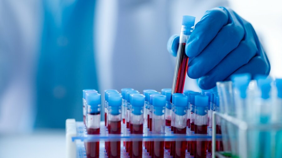 Καινοτομία: Συνθετικά αιμοπετάλια σταματούν τη σοβαρή αιμορραγία
