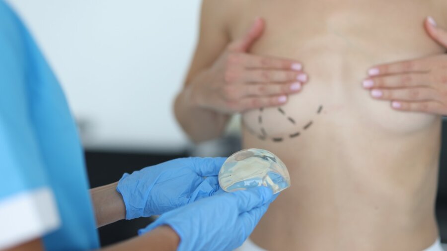 Καρκίνος: Πόσο πιθανή είναι η εμφάνιση του σε γυναίκες που τοποθετούν εμφυτεύματα στήθους