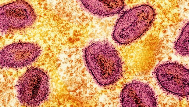 Mpox: Ανοίγει και έκτο εμβολιαστικό κέντρο – Οι ευάλωτες ομάδες