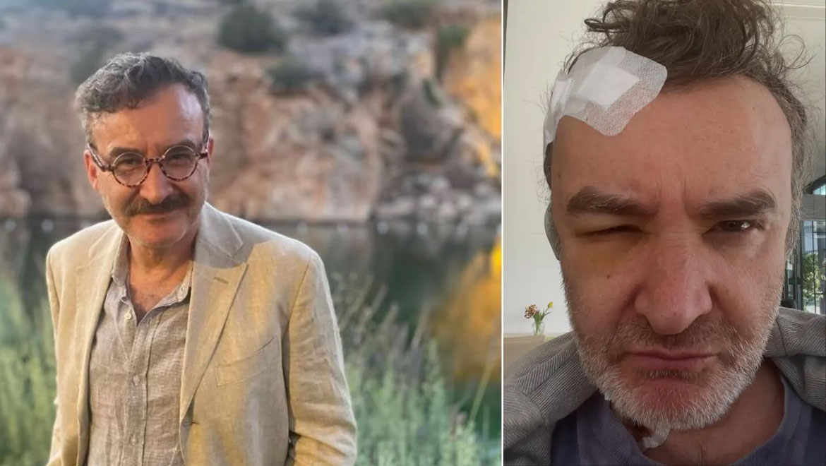 Νίκος Ορφανός: Η πρώτη ανάρτηση μετά το ατύχημα που είχε