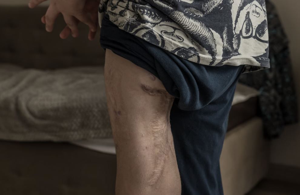 Ουκρανία: Χιλιάδες παιδιά εξαφανίστηκαν στη Ρωσία - Αυτό όμως το αγόρι επέστρεψε