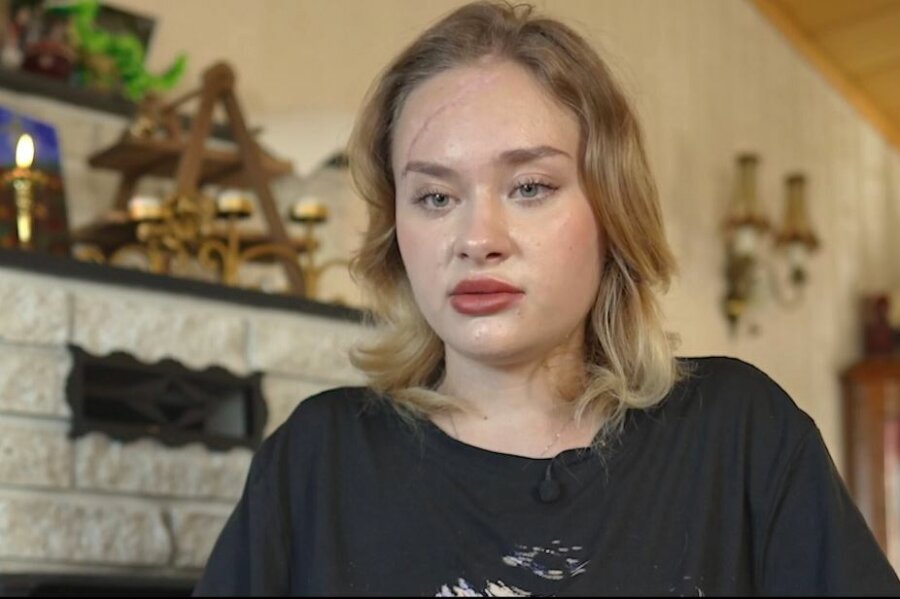 Μαρία Κοβαλτσούκ: Φωτογραφίες σοκ μετά την κακοποίηση που φέρεται να υπέστη στο Ντουμπάι