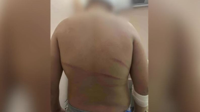 Θεσσαλονίκη: Συμμορία κουκουλοφόρων ξυλοκόπησε άγρια 13χρονο [εικόνες σοκ]