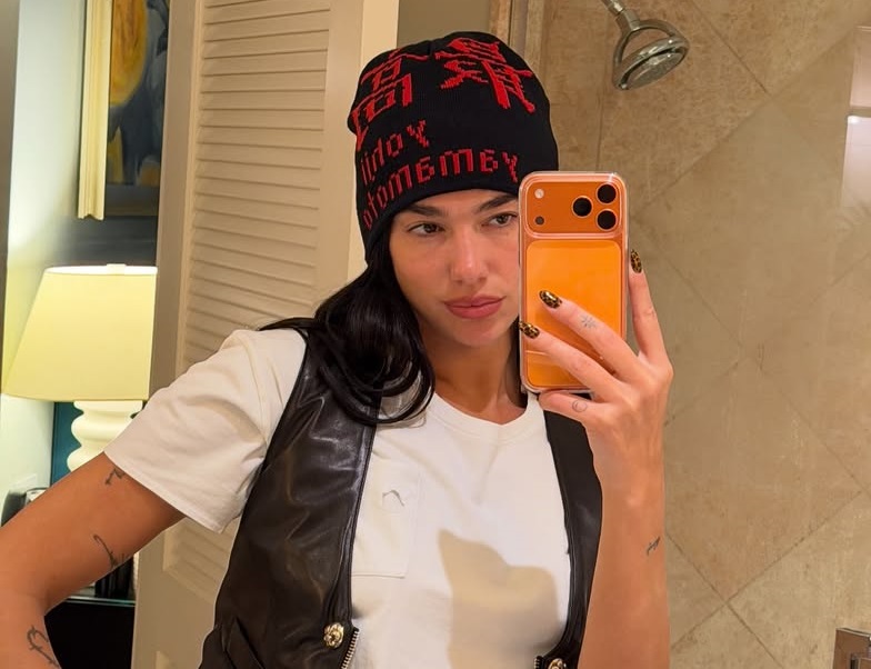 Dua Lipa με «tortoise shell» νύχια: Το διαχρονικό nail trend που γίνεται ξανά viral