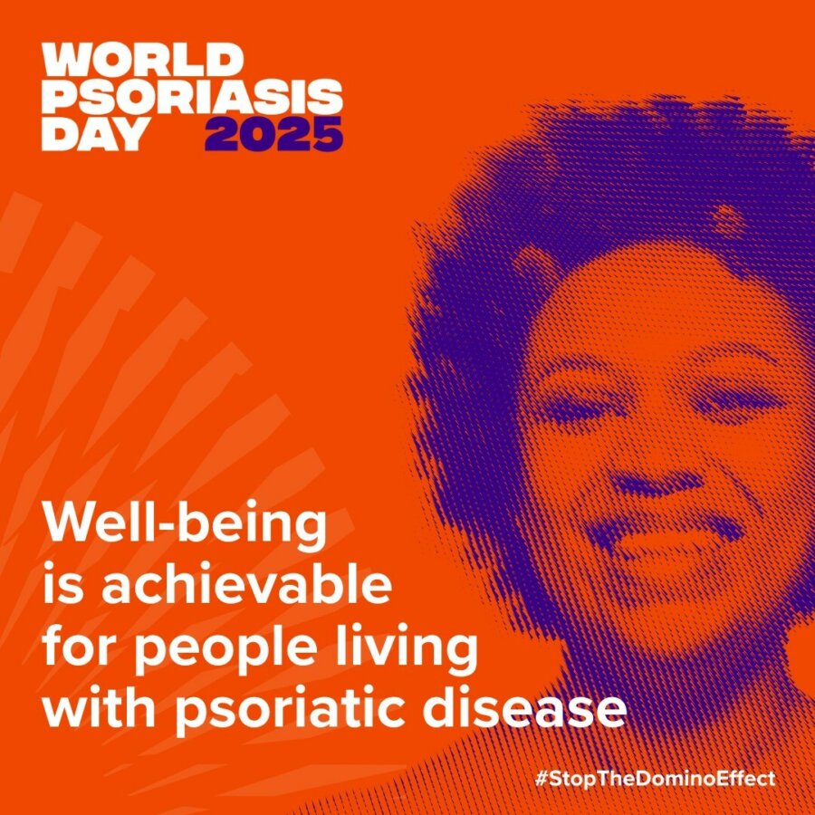 Ζώντας με την ψωρίαση: μια ειλικρινής εξομολόγηση για την Παγκόσμια Ημέρα Ψωρίασης