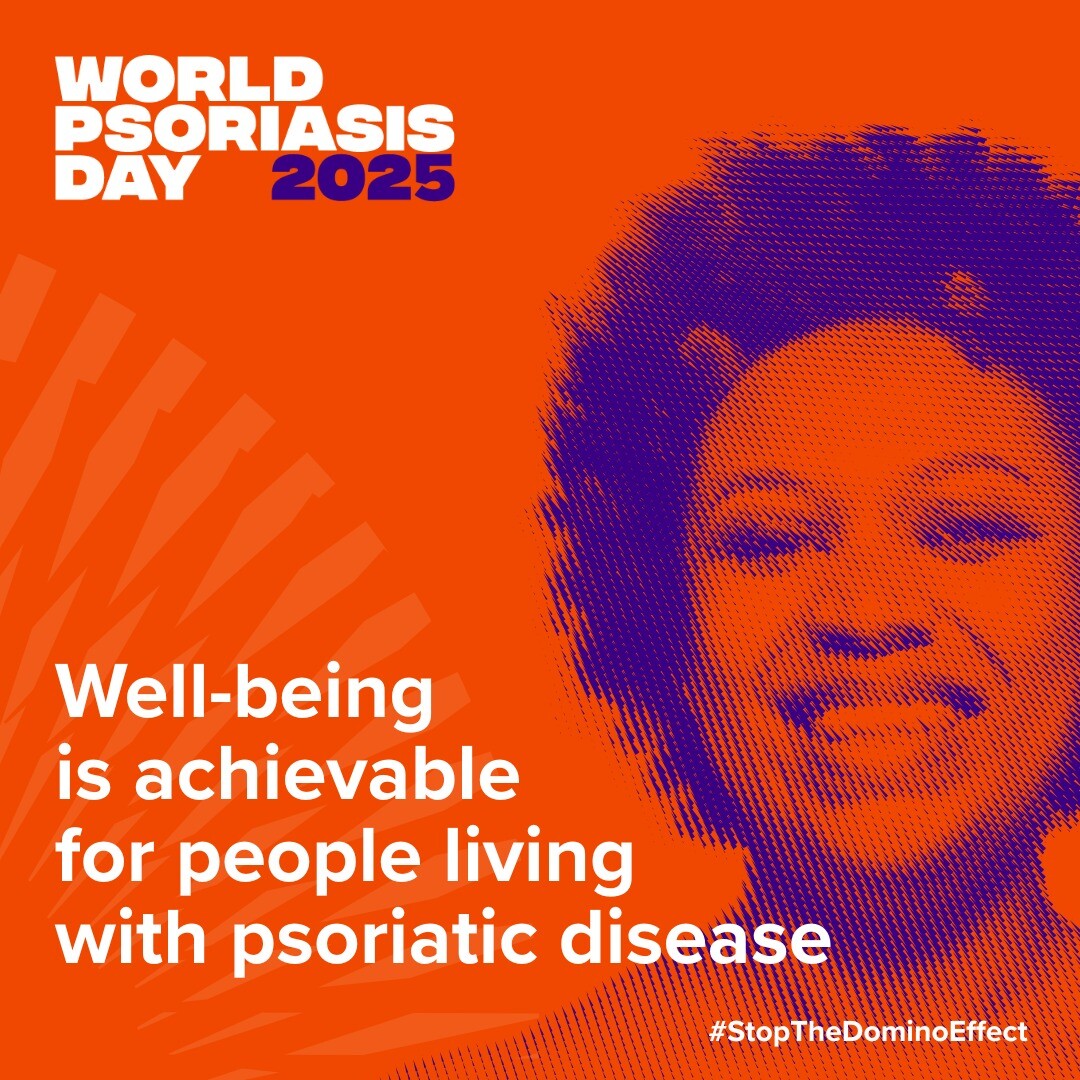 Ζώντας με την ψωρίαση: μια ειλικρινής εξομολόγηση για την Παγκόσμια Ημέρα Ψωρίασης