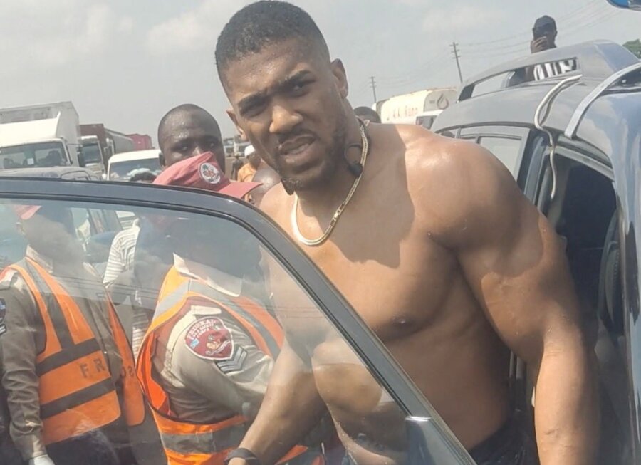 Anthony Joshua μετά το ατύχημα