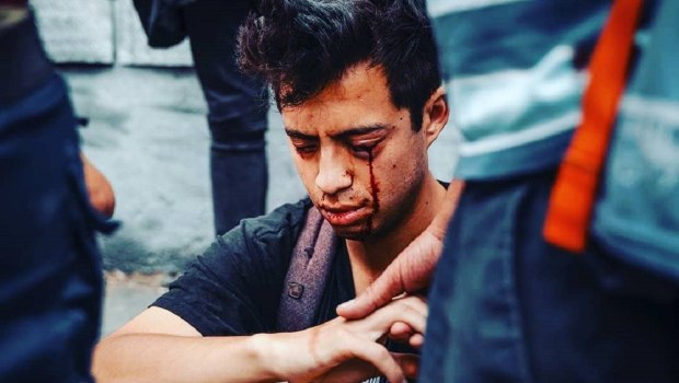 Χιλή: Αθώωσαν τον αστυνομικό που πυροβόλησε και τύφλωσε διαδηλωτή στις μεγάλες κινητοποιήσεις το 2019