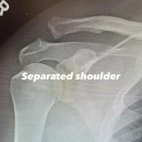 Channing Tatum: Στο νοσοκομείο ο Αμερικανός ηθοποιός - Τι συνέβη