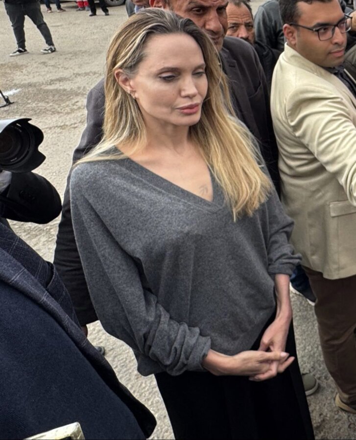 Αντζελίνα Τζολί:«Δεν υπάρχει γεμάτη ζωή χωρίς σημάδια»