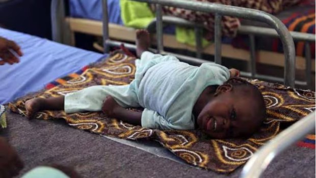 Η μηνιγγίτιδα σκοτώνει πάνω από 250.000 ανθρώπους σε όλον τον κόσμο κάθε χρόνο - Το ένα τρίτο είναι παιδιά