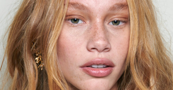 Σημάδια ακμής στην επιδερμίδα: Τρία tip για να τα εξαφανίσετε