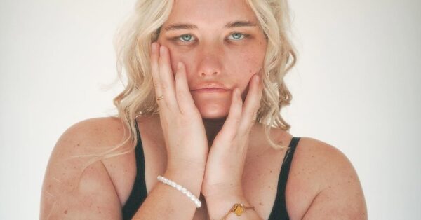 Το κορίτσι που δεν χαμογελάει ποτέ: 28χρονη Influencer μιλάει για τη ζωή της με το σπάνιο σύνδρομο Moebius