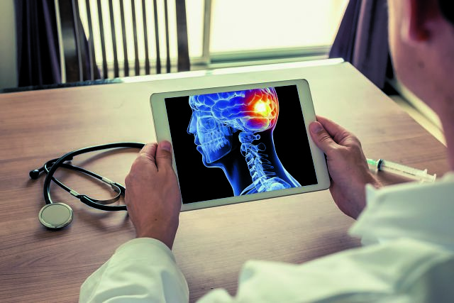 Τι είναι η ρήξη ανευρύσματος εγκεφάλου – Αιτίες και κίνδυνοι