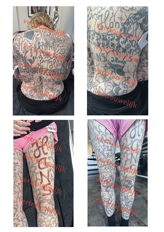 Ολλανδία: Έκανε 250 τατουάζ με το όνομά του στο κορμί της συντρόφου του [εικόνες και βίντεο]