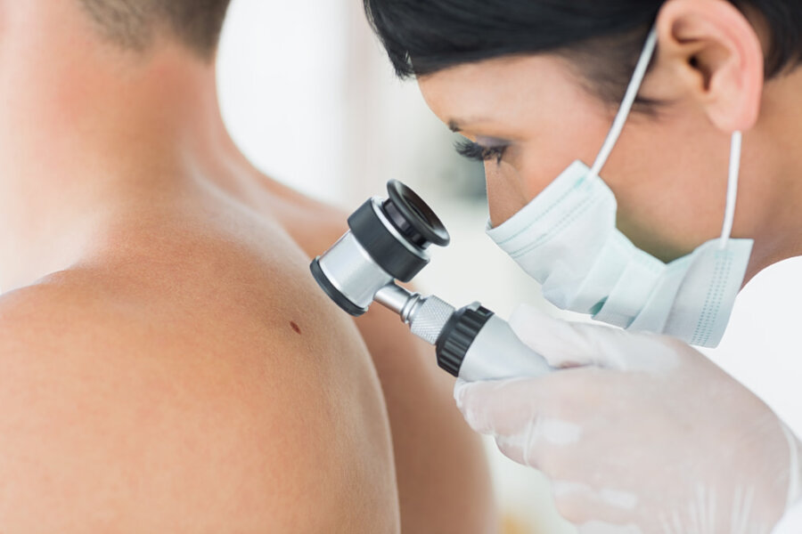 melanoma-karkinos-dermatos