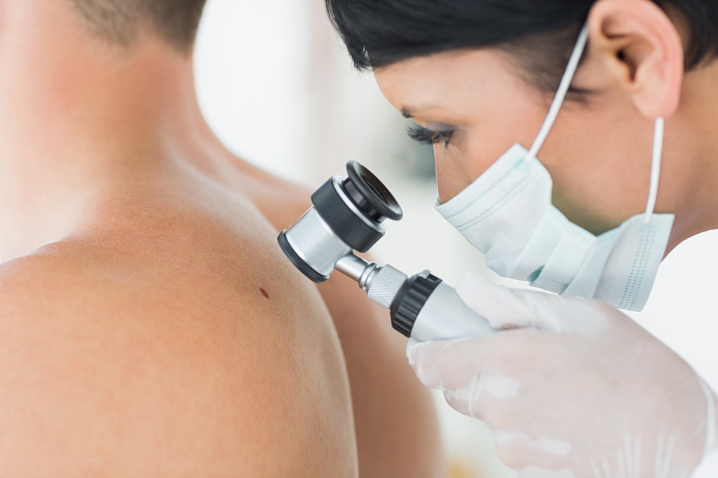 melanoma-karkinos-dermatos