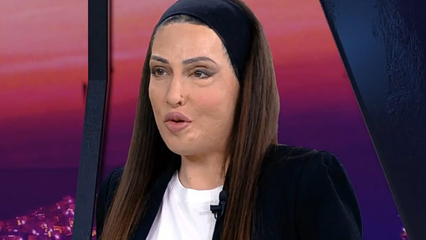 «Έξι χρόνια μετά, διαλέγω ακόμα τη ζωή»: Συγκινεί η Ιωάννα Παλιοσπύρου - Η ανάρτησή της