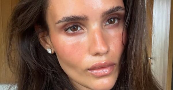 Η skincare ρουτίνα που χρειάζεται η επιδερμίδα μας μετά από ένα ηλιακό έγκαυμα