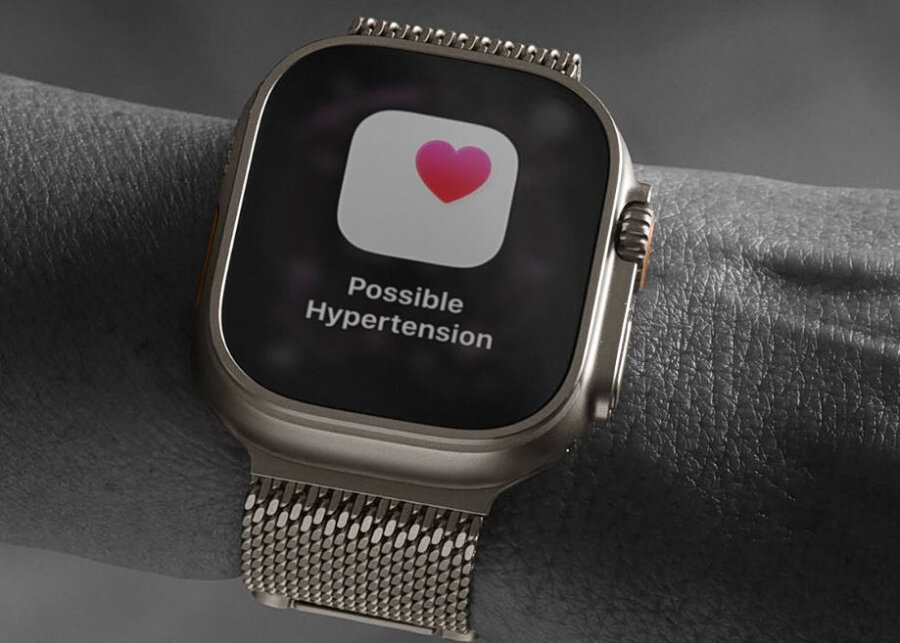 Το smartwatch λέει ότι είσαι άρρωστος; – Οι γιατροί λένε «προσοχή»