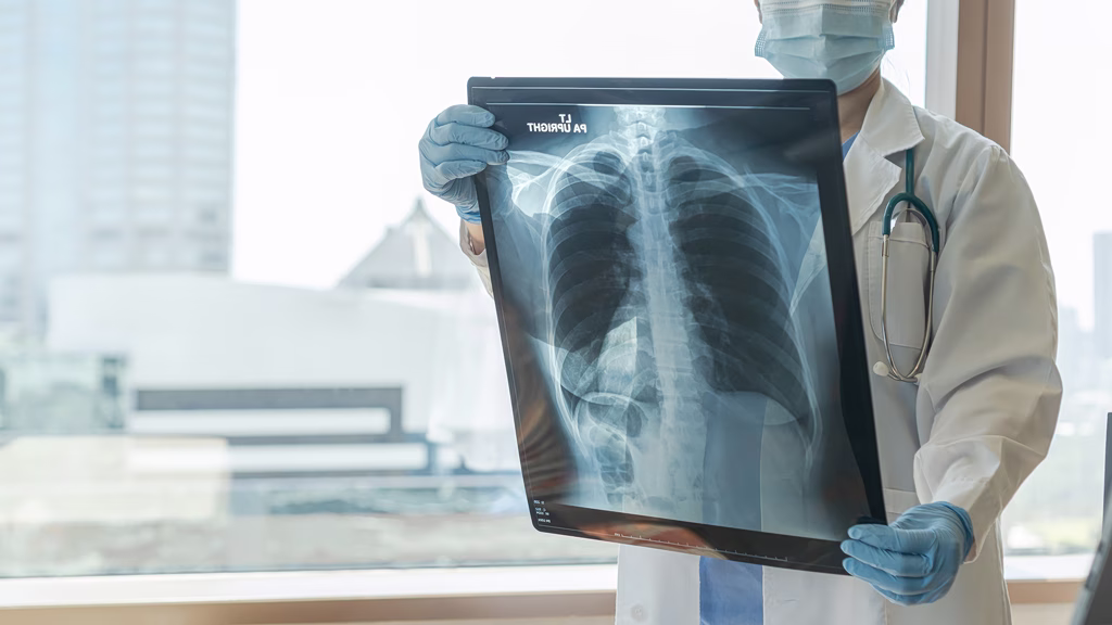 lung-cancer